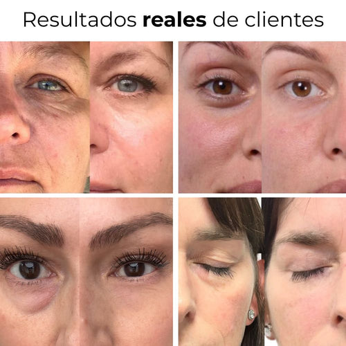 Parches PuraDerma™