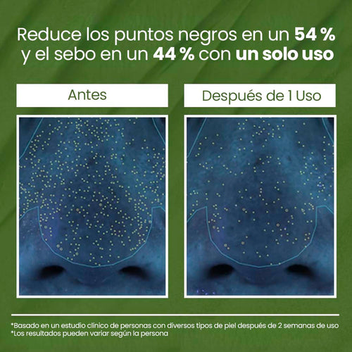 Bubbly® - Mascarilla de Burbujas de Albahaca