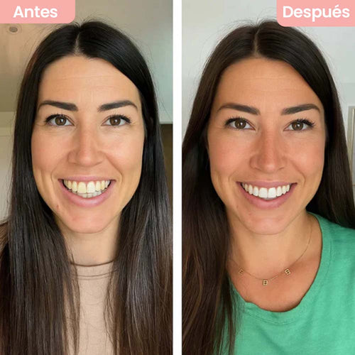 Dentify® - Pasta Dental Blanqueadora con Niacinamida