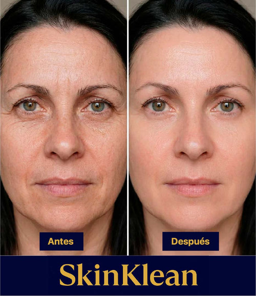 SkinKlean® – Ampolla Reafirmante de Colágeno y Péptidos