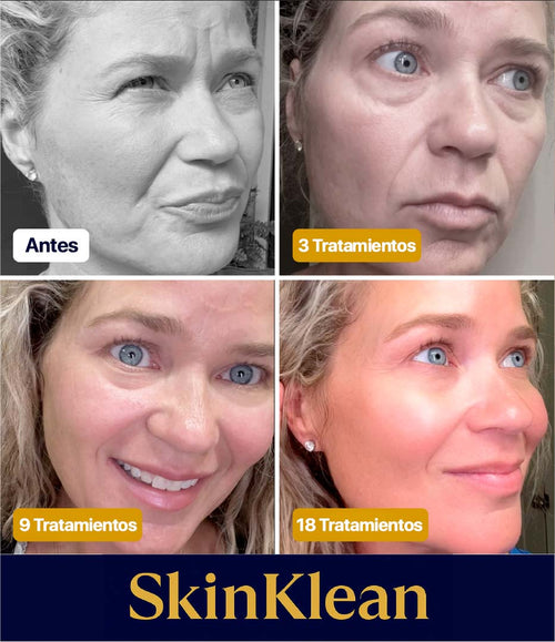 SkinKlean® – Ampolla Reafirmante de Colágeno y Péptidos