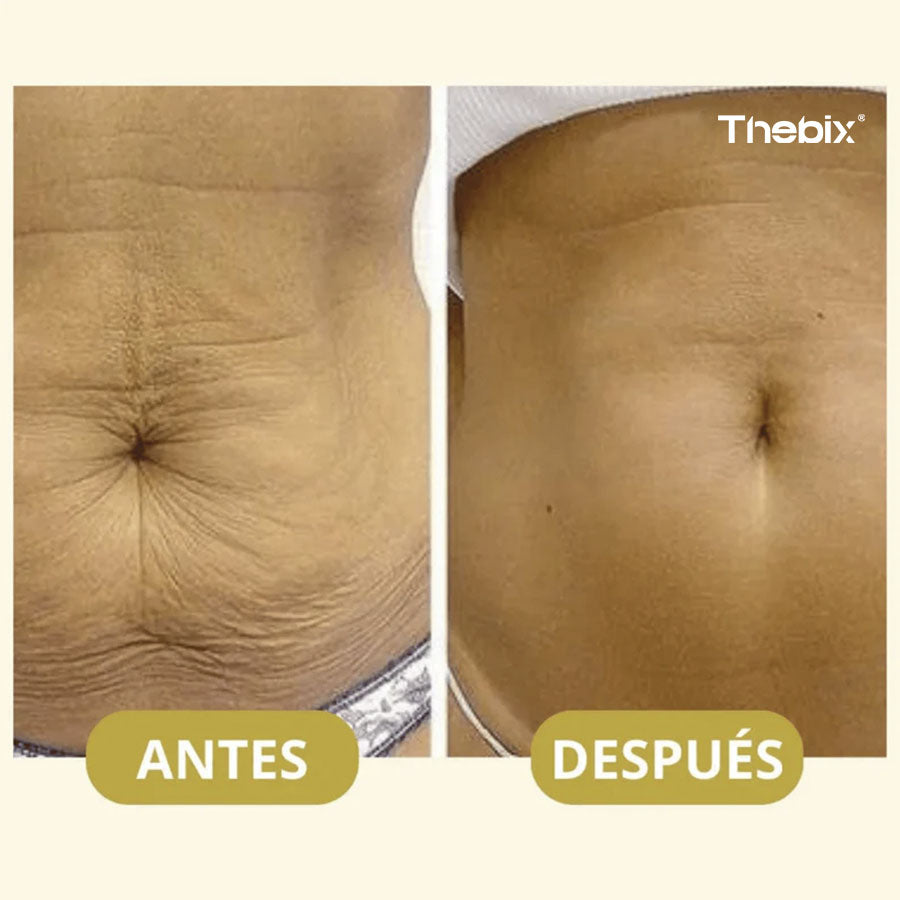 CurezPro® – Aceite MAGIC Reafirmante - 100ml